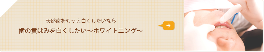 天然歯をもっと白くしたいなら 歯の黄ばみを白くしたい～ホワイトニング～