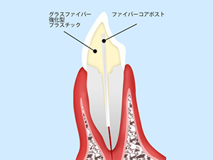 ファイバーコア